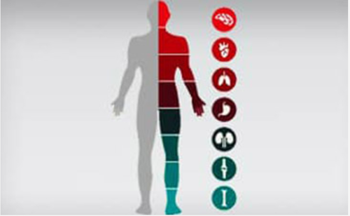 metro whole body check 500x500
